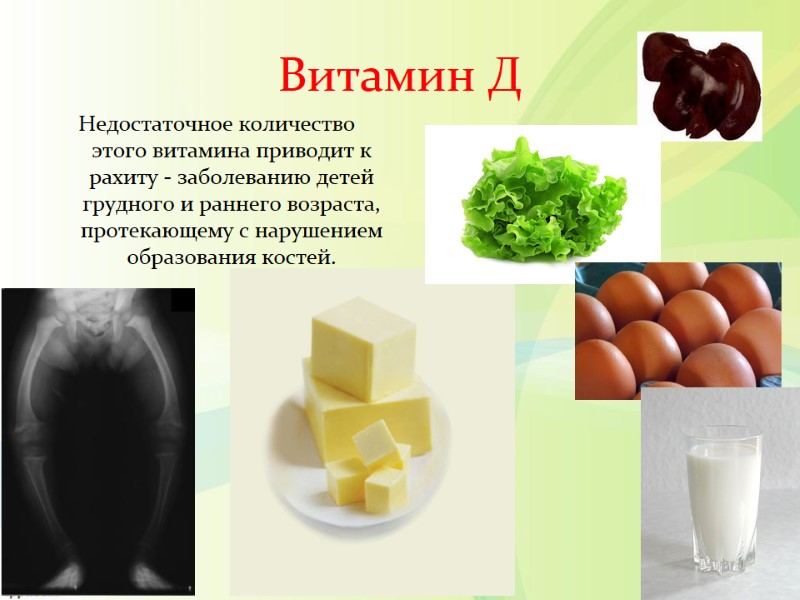 Витамин Д Недостаточное количество этого витамина приводит к рахиту - заболеванию детей грудного и